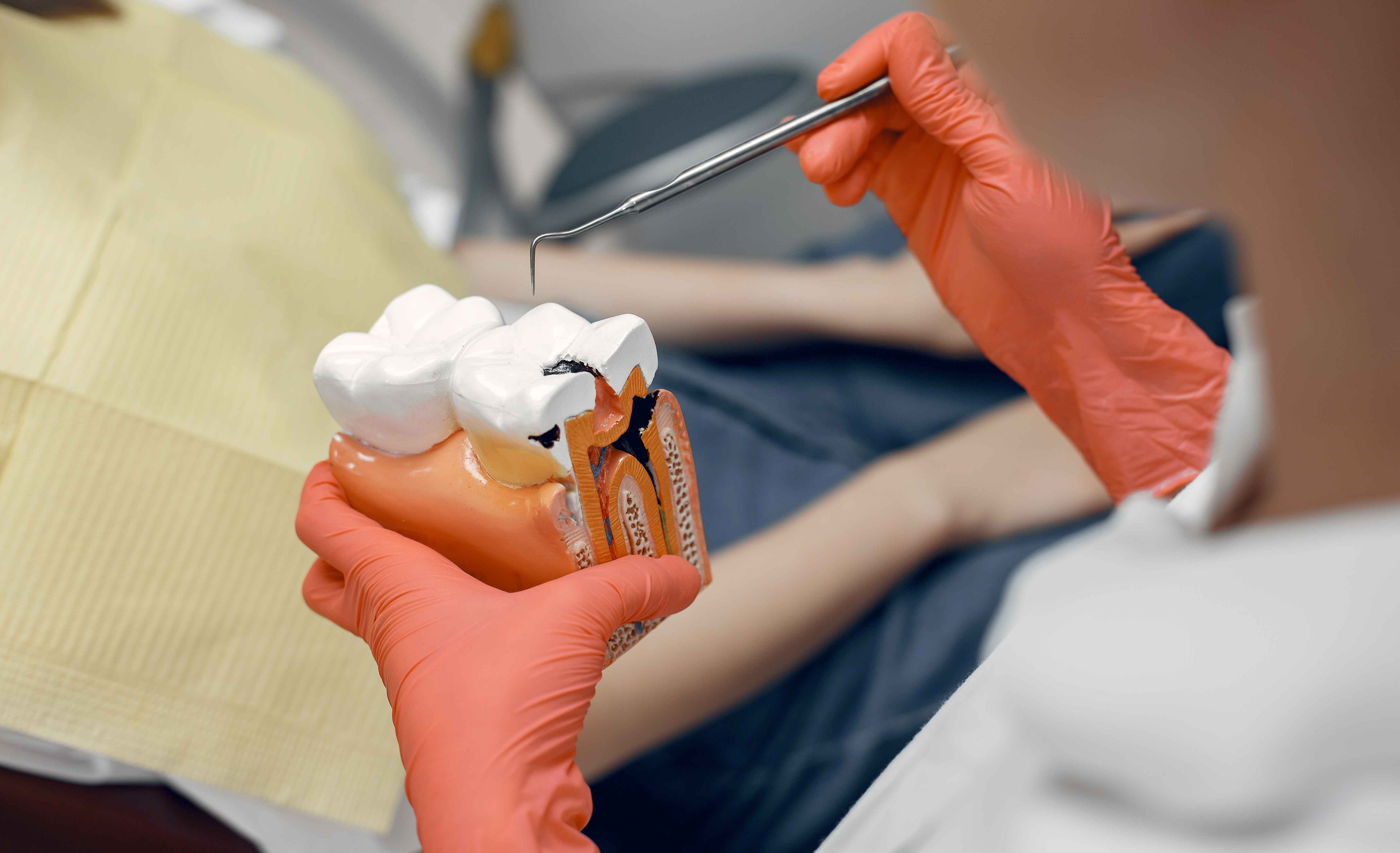 Fundamentals Of Wisdom Tooth Surgery