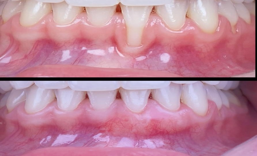 Soft Tissue Immersion  A Two Day Comprehensive Program