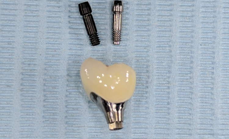 Comprehensive Prosthetic Implant Dentistry Program Integrated Surgical And Prosthetic Training 